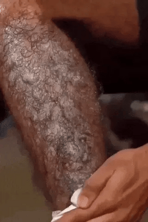 Hair Removal Spray – Smooth Skin Hair Removal Solution